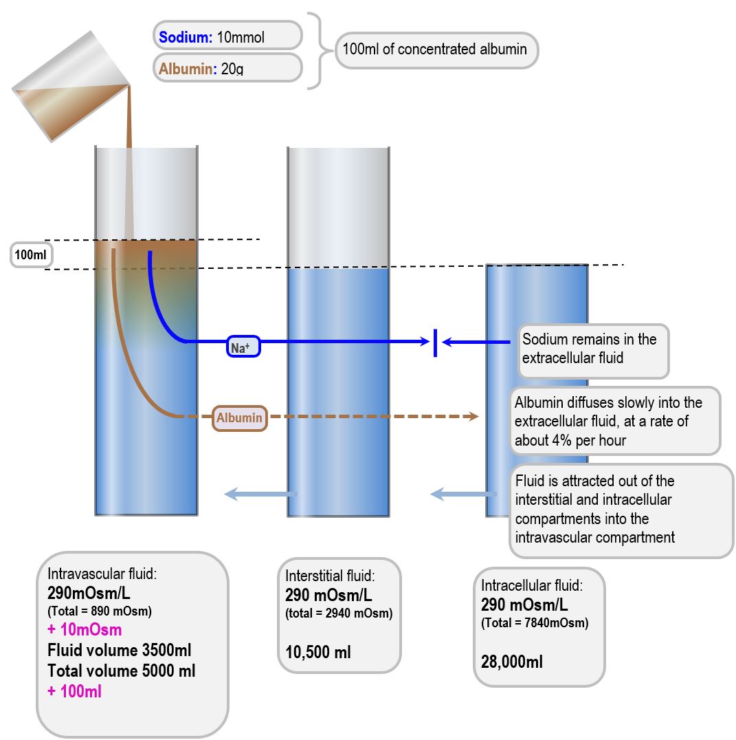 Response to 100ml of concentrated (20%) human albumin | Deranged Physiology
